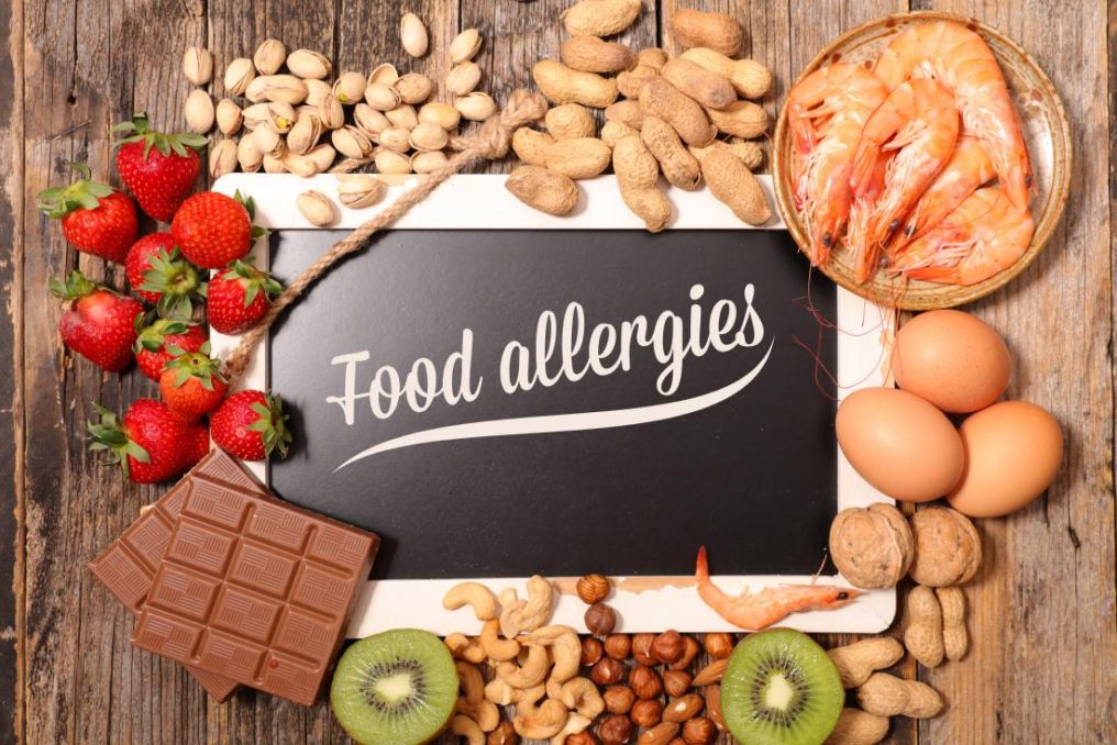 A chalkboard surrounded by food that reads food allergies